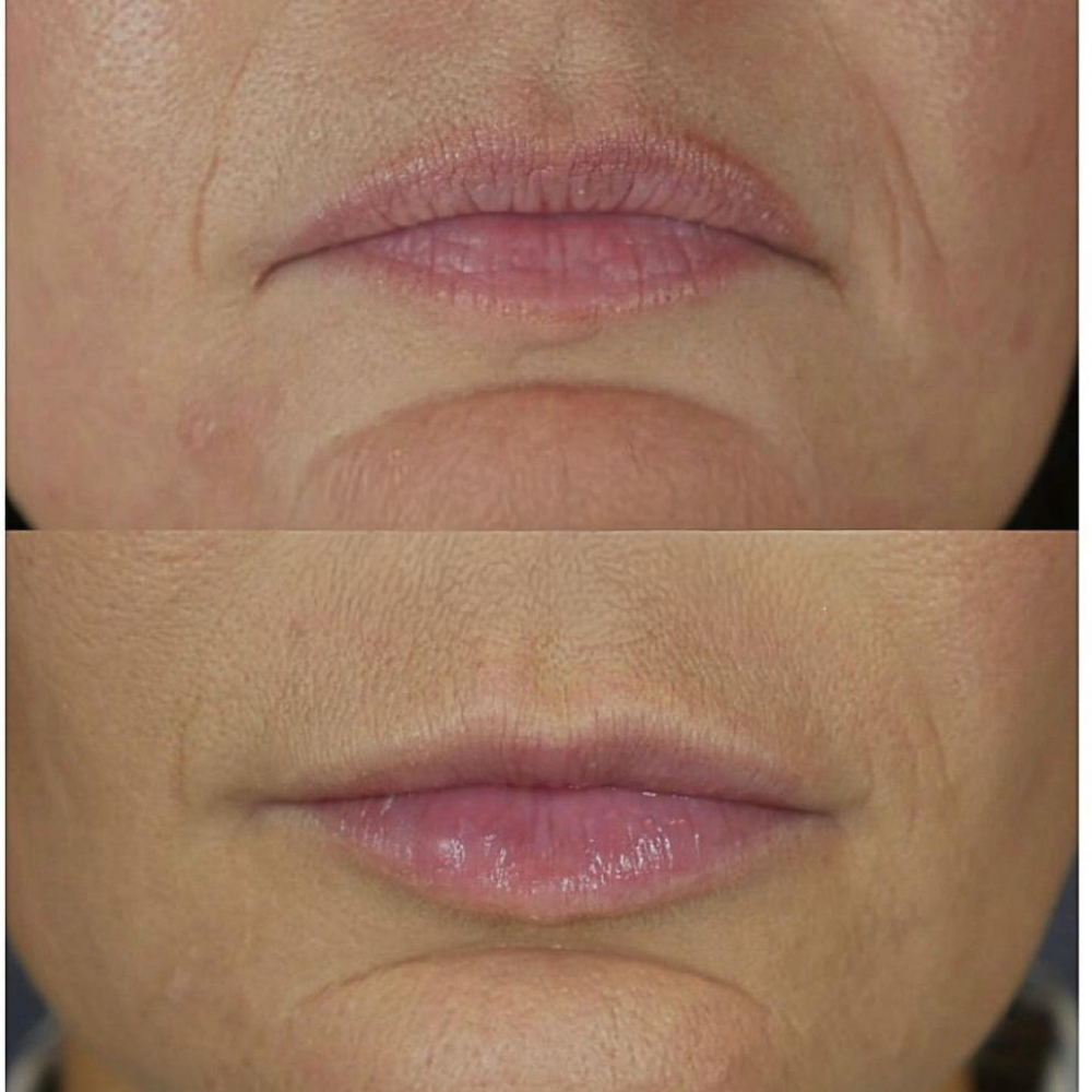 Turn Your Frown Upside Down at Alluring Soul in Joplin, MO