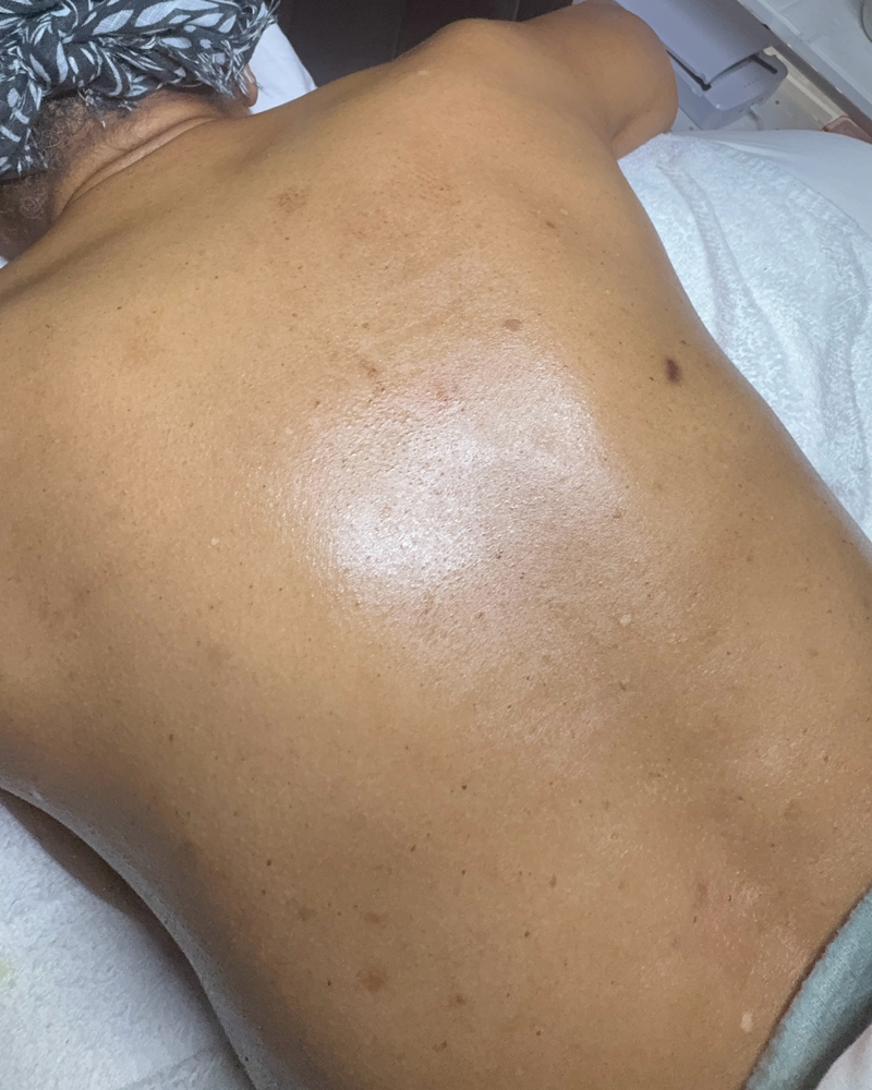 Back Facial