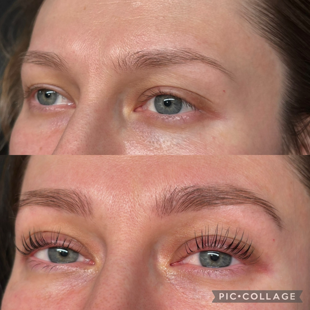 Eyelash Lifting