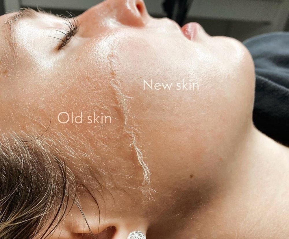 Dermaplaning  Add On ✨