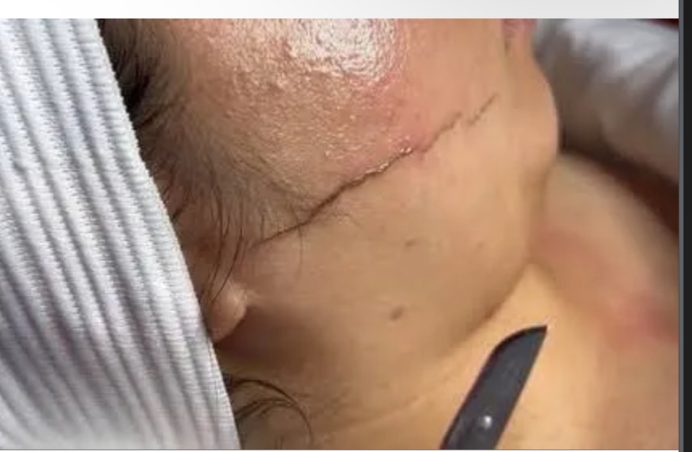 Dermaplaning + facial