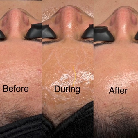 Luxe Lift Circadia Facial at Santana Skin Studio in El Paso, TX