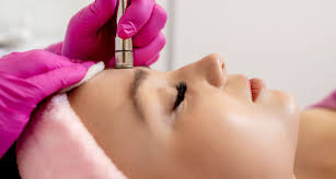 Microderm Facial