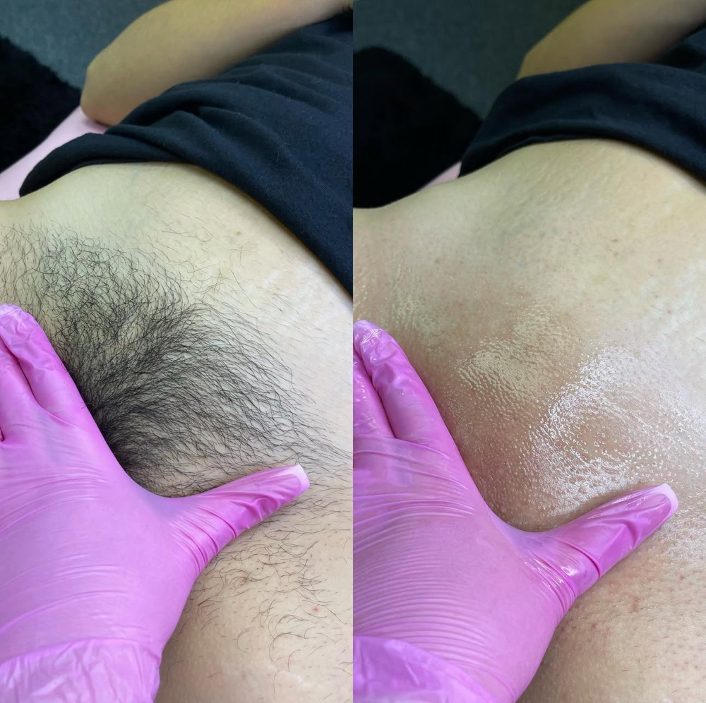 Brazilian Wax