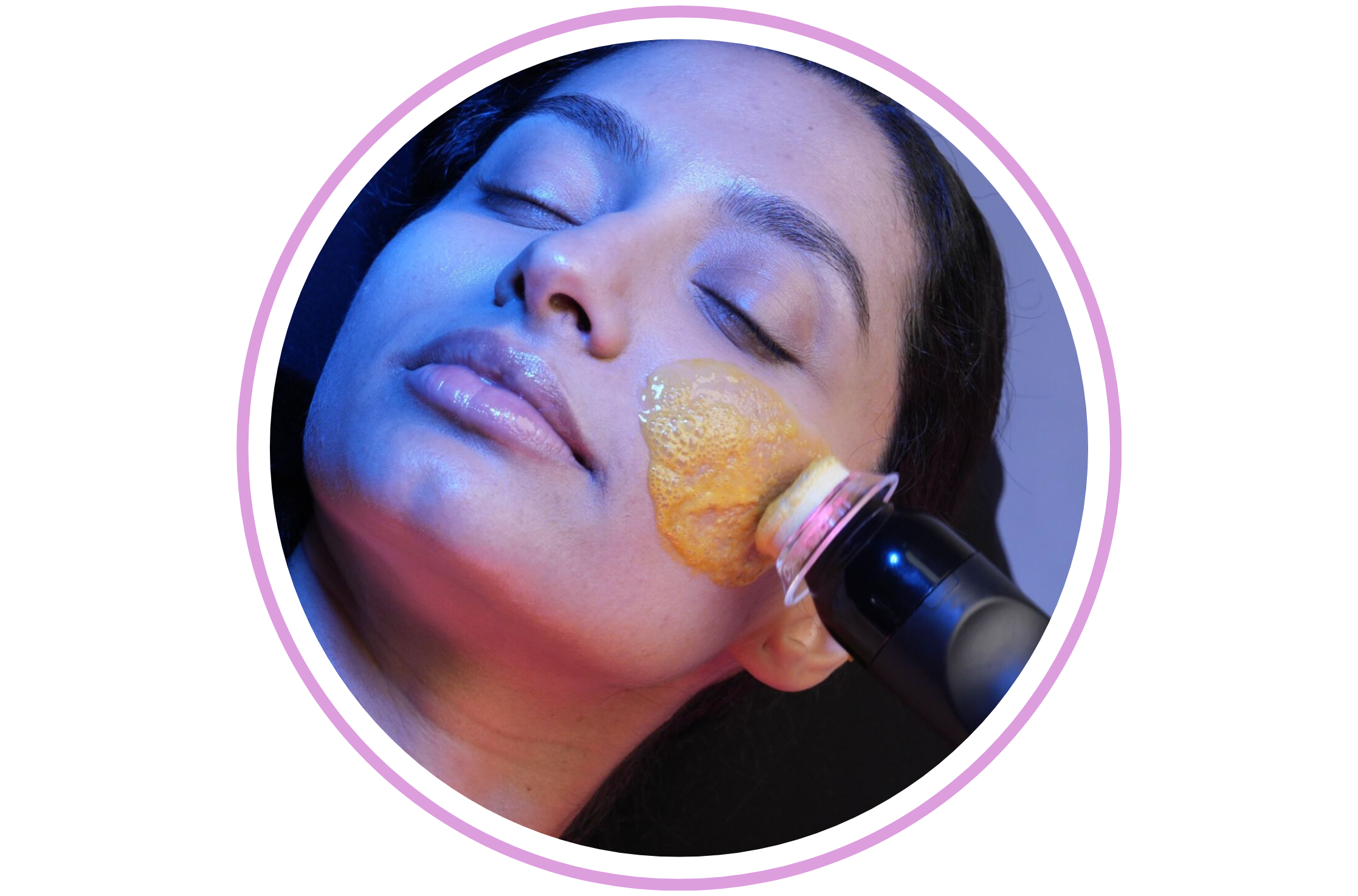 Platinum Glo2Facial
