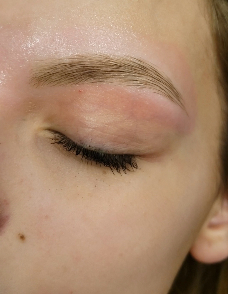 Radiant Removal at Ivory Crown Salon in Mt Juliet, TN