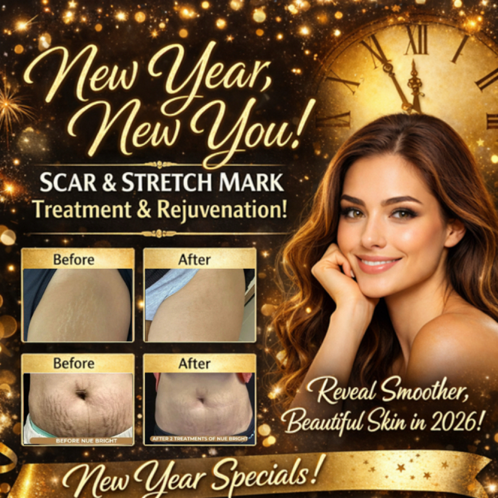 🚨NEW YEAR PROMO‼️ $150 1st Session