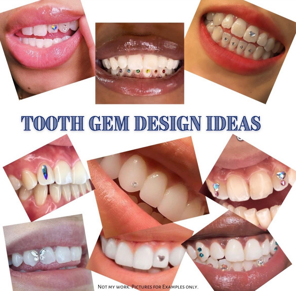 6 Tooth Gems