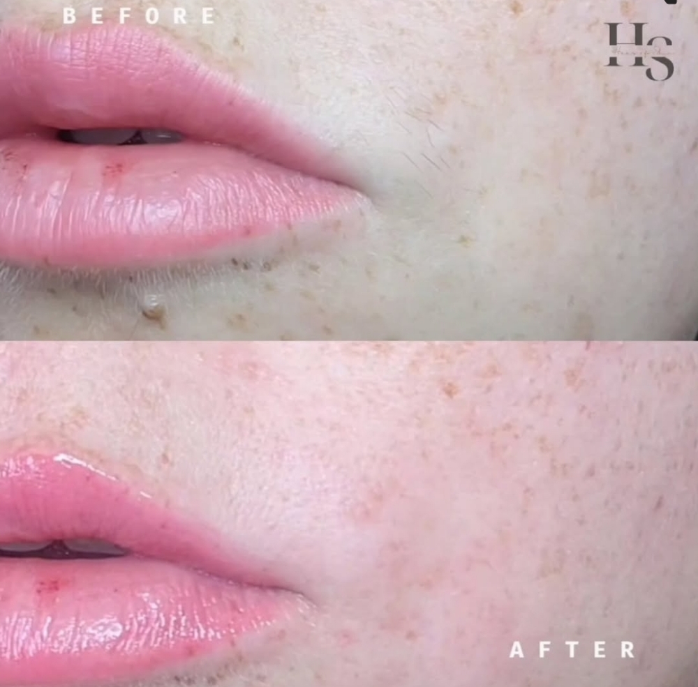 Lip Wax at Haus Of Skin in Burleson, TX