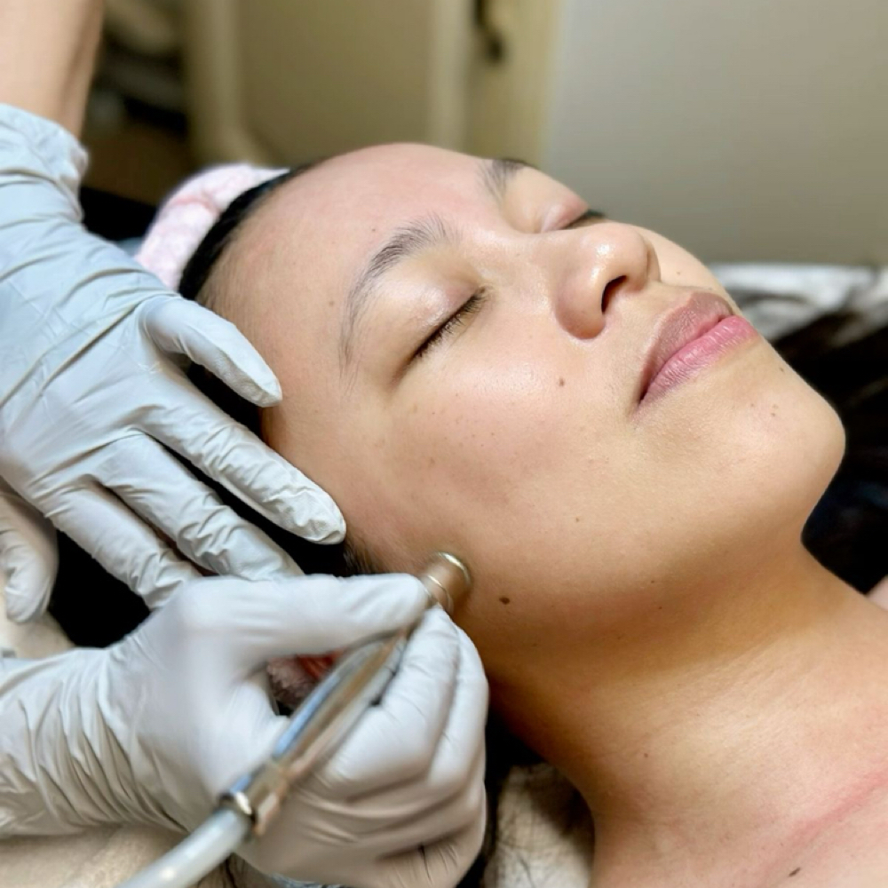 Microdermabrasion Facial at Aesthetics By Aleigha in Florence, SC