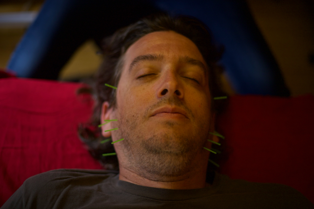 Elite Acupuncture Follow Up at Acupuncture North in Minneapolis, MN