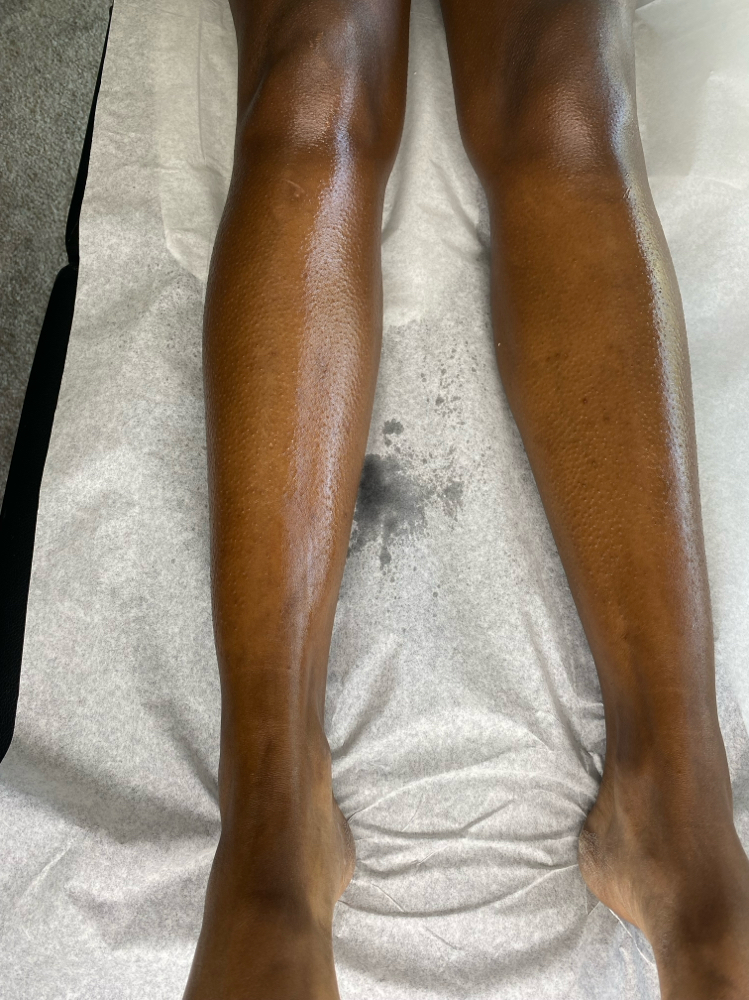 Full Legs at Euphoric Skin and Beauty in Hampton, GA