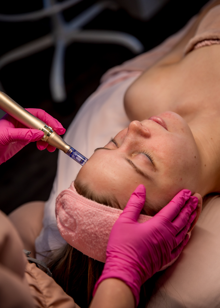 Microneedle Facial