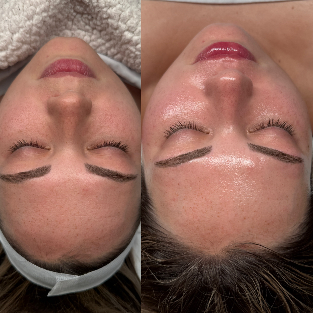 O2 Luminance Facial