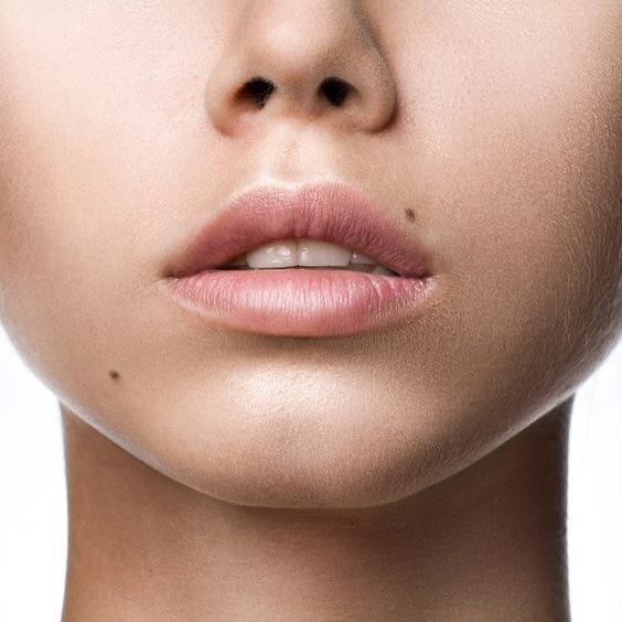 Beauty Spots