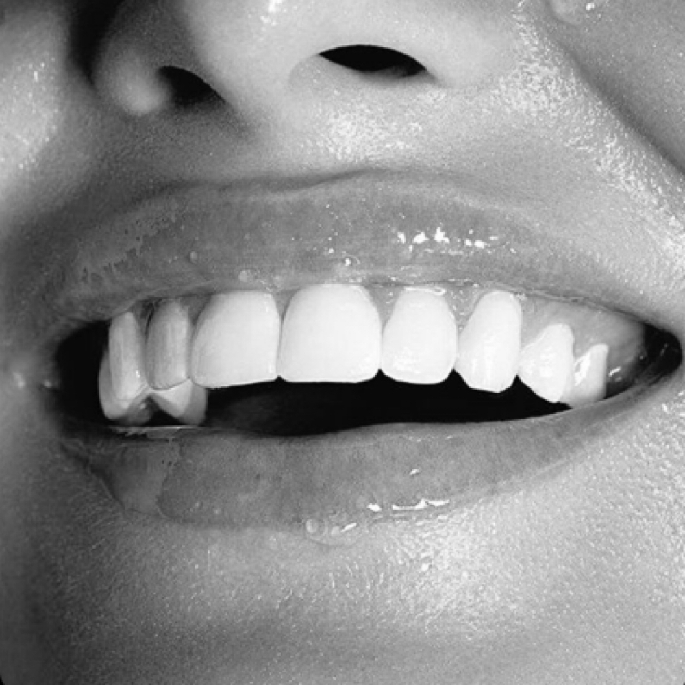 Teeth Whitening 30 Minute at Luxe Esthetics in 95688