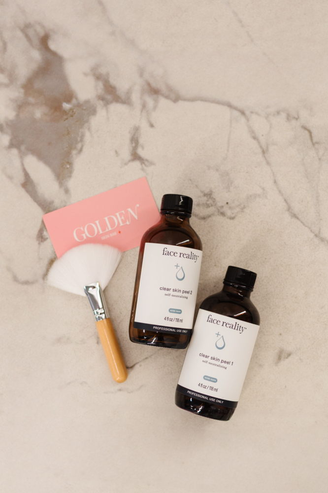 Acne Bootcamp Inital Consult + Peel at Golden Skin Bar in Mesa, AZ