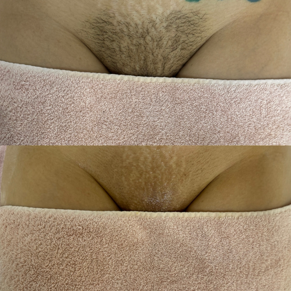 Brazilian at Pretty Essence in South Gate, CA