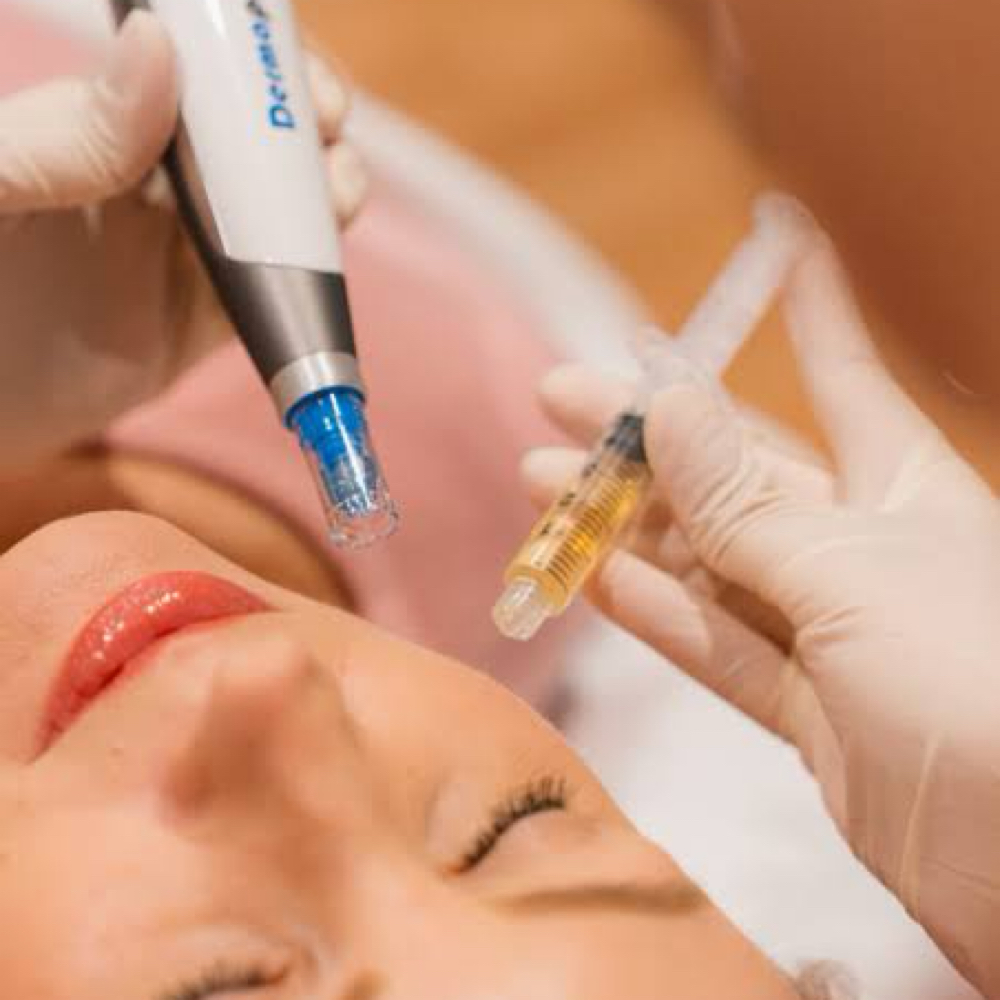 PRP Facial Vampire at Haus of Beauty Studio in Hialeah, FL