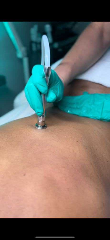Back Exfoliation Facial