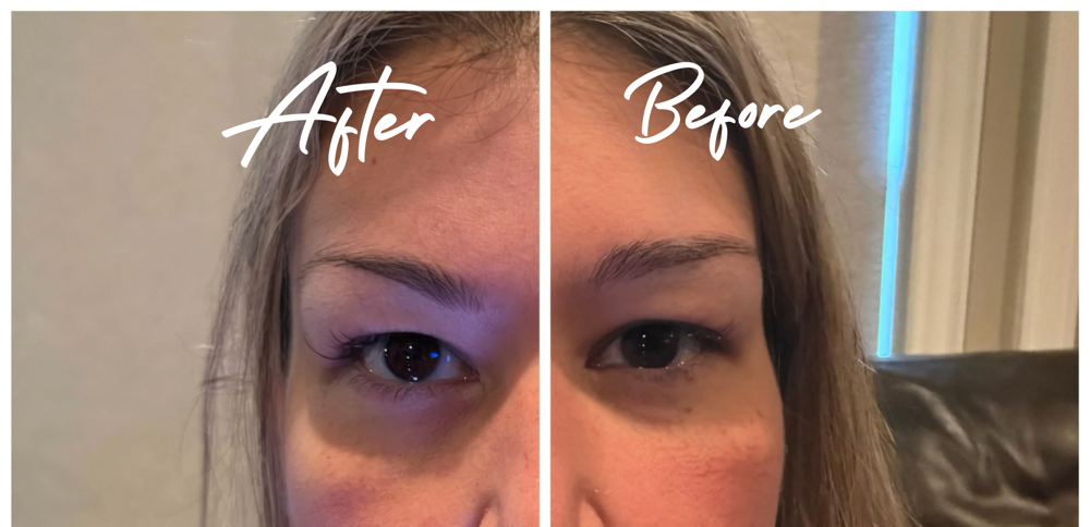 Brow lift at Lavish.withLo in Sunnyvale, TX