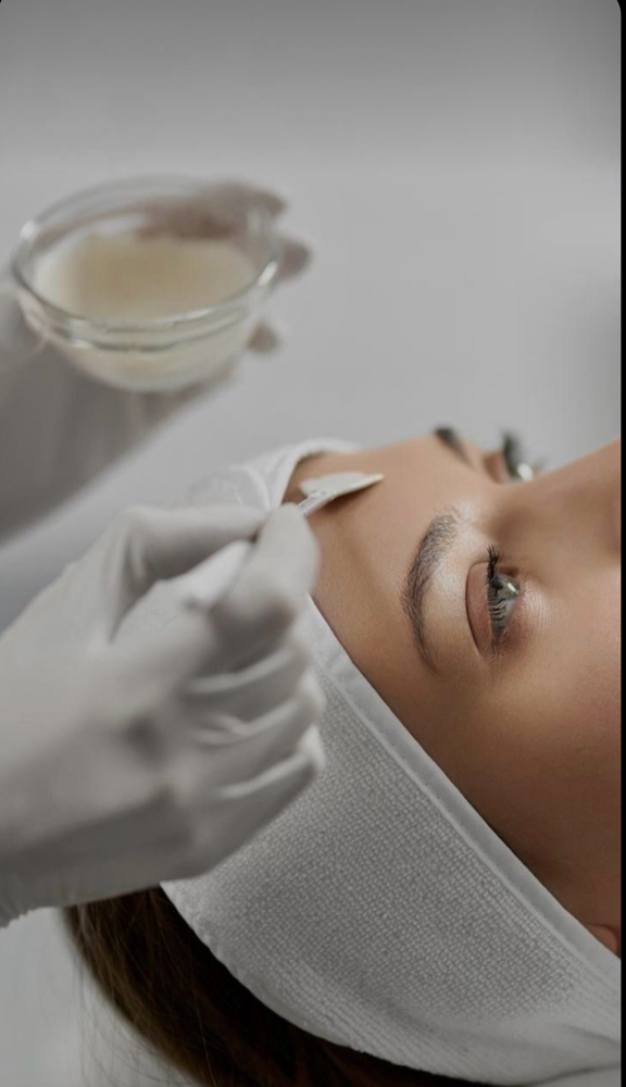 Chemical Peel Package