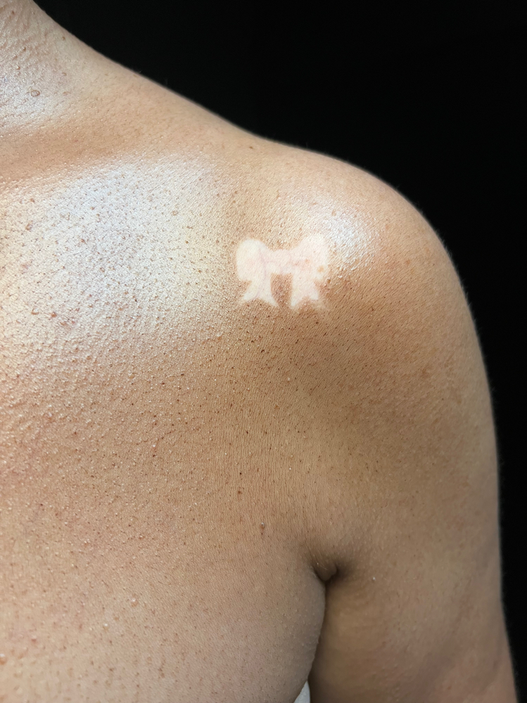 Rapid Spray Tan