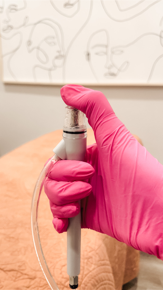 Hydrodermabrasion Deluxe Facial