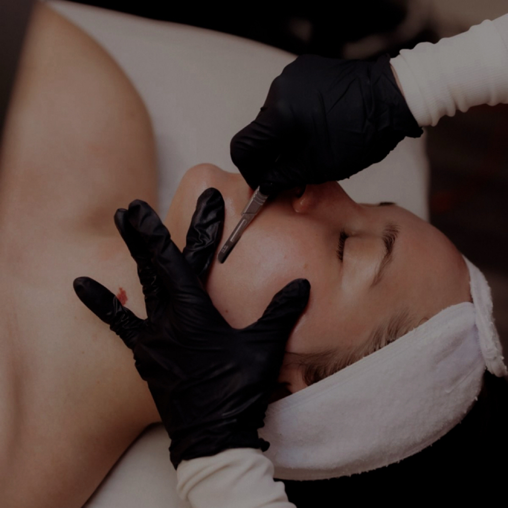 Dermaplane Facial at Ems Esthetics in Jerseyville, IL