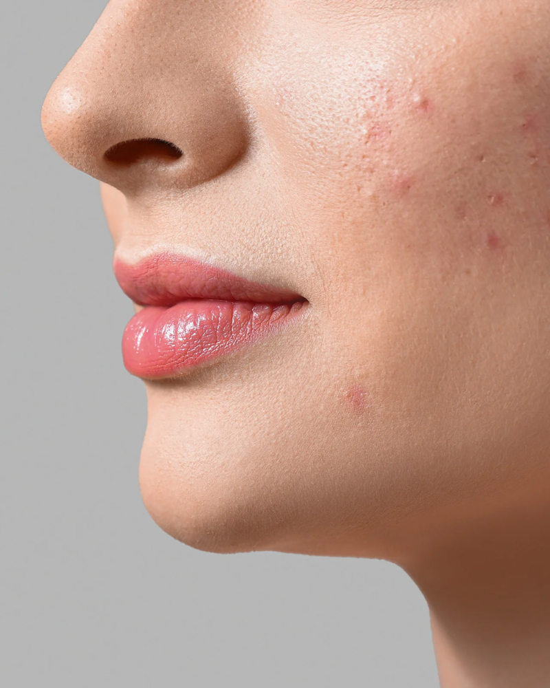 Breakout Bootcamp Facial