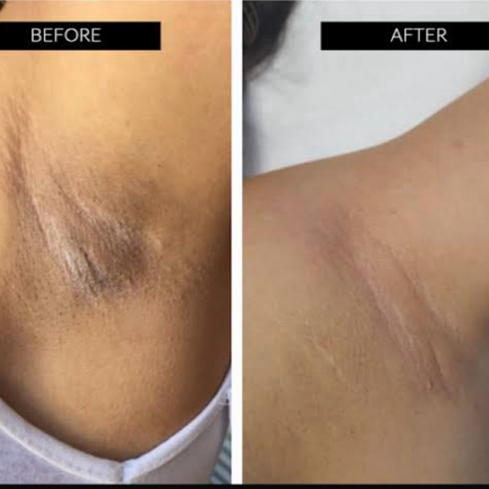 Intimate Bleaching at Shape Me Beauty Studio in Midland, TX