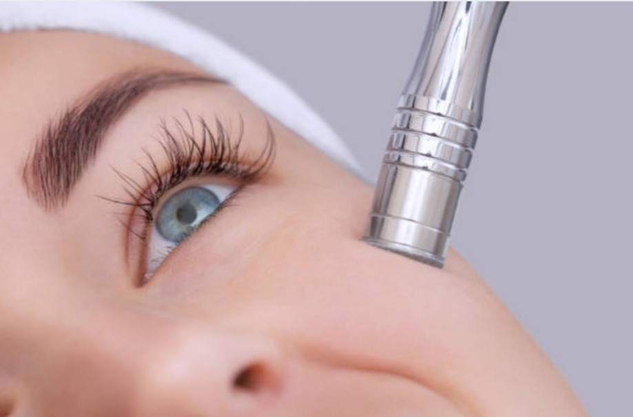 Non-Surgical Microcurrent Facelift