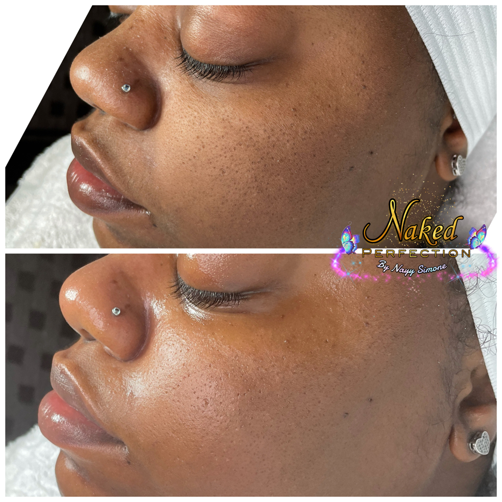 Basic Facial