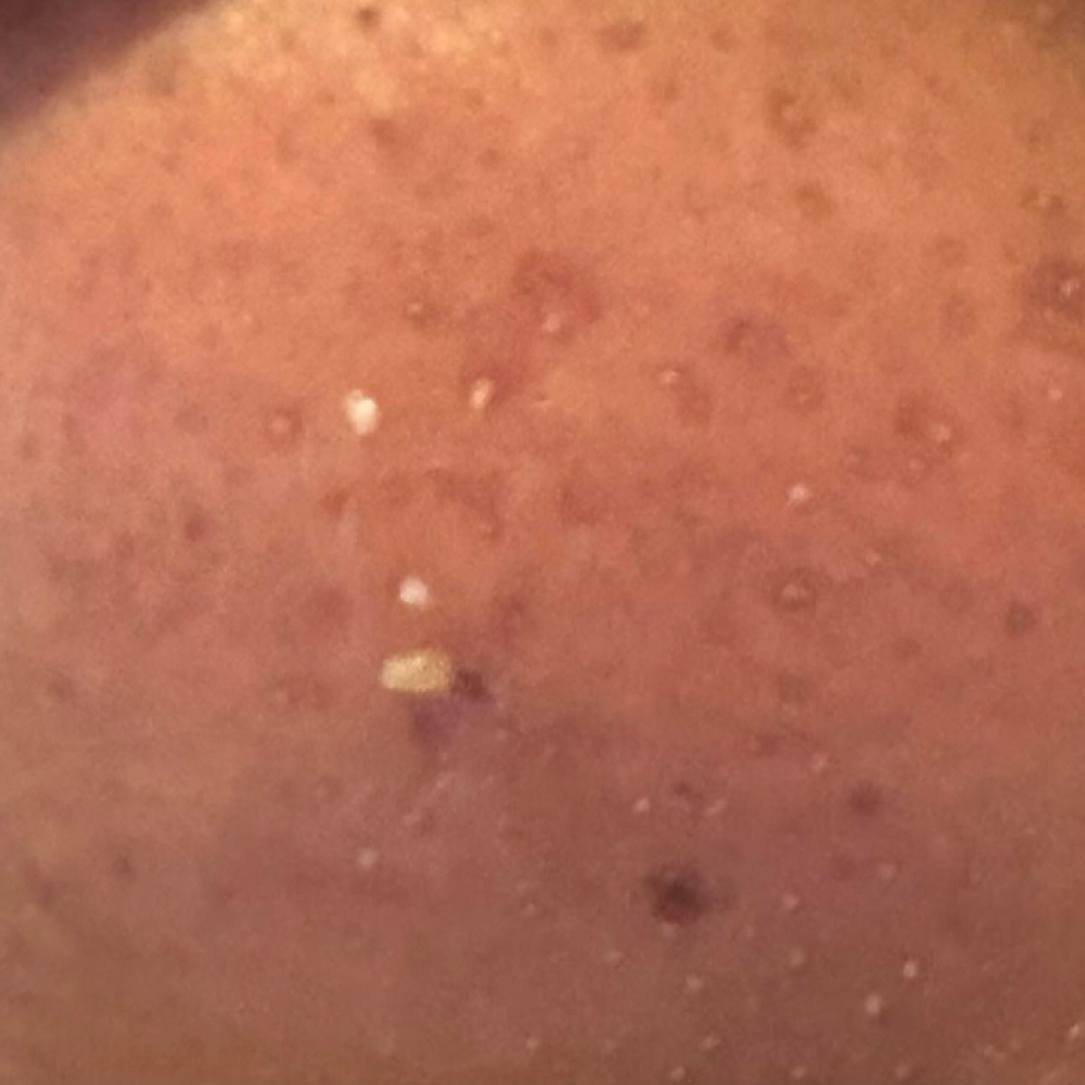 Modality Treatments at Rockii’s intimate skin & esthetics in Va Beach, VA
