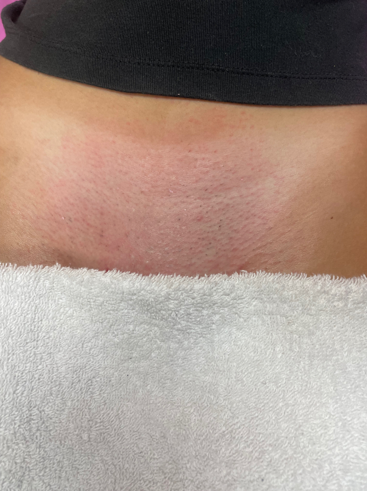 New Client Brazillian (Women Only)