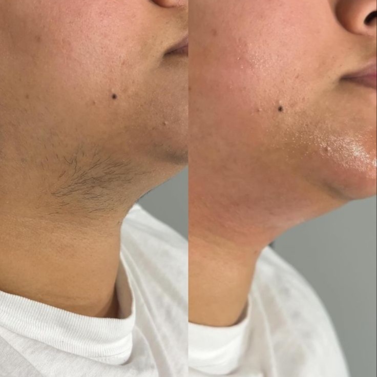 Chin Wax at VeleaRaeStudio in Tempe, AZ