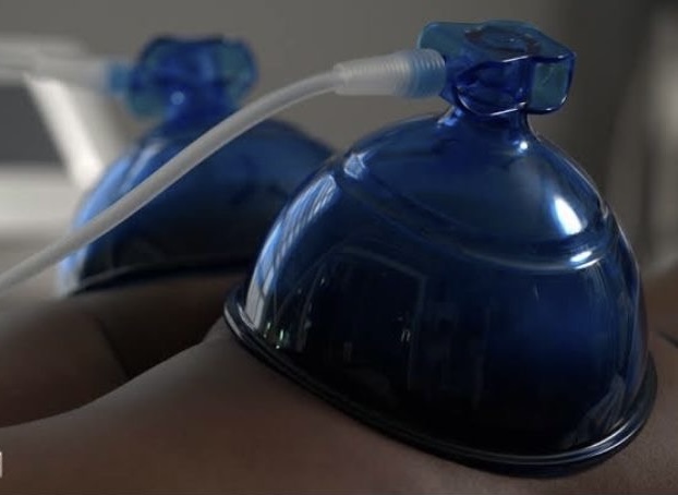 Book 6 Vaccum Therapy Treatments