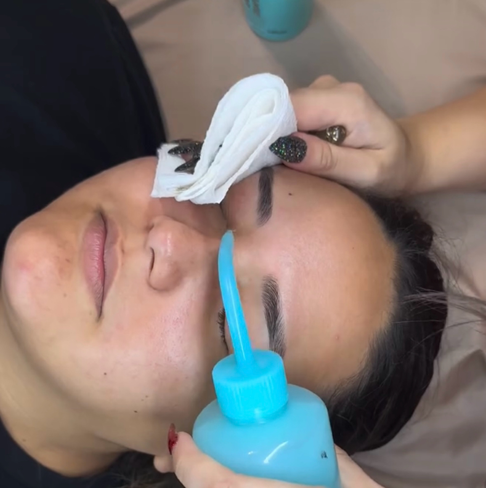 Lash Removal