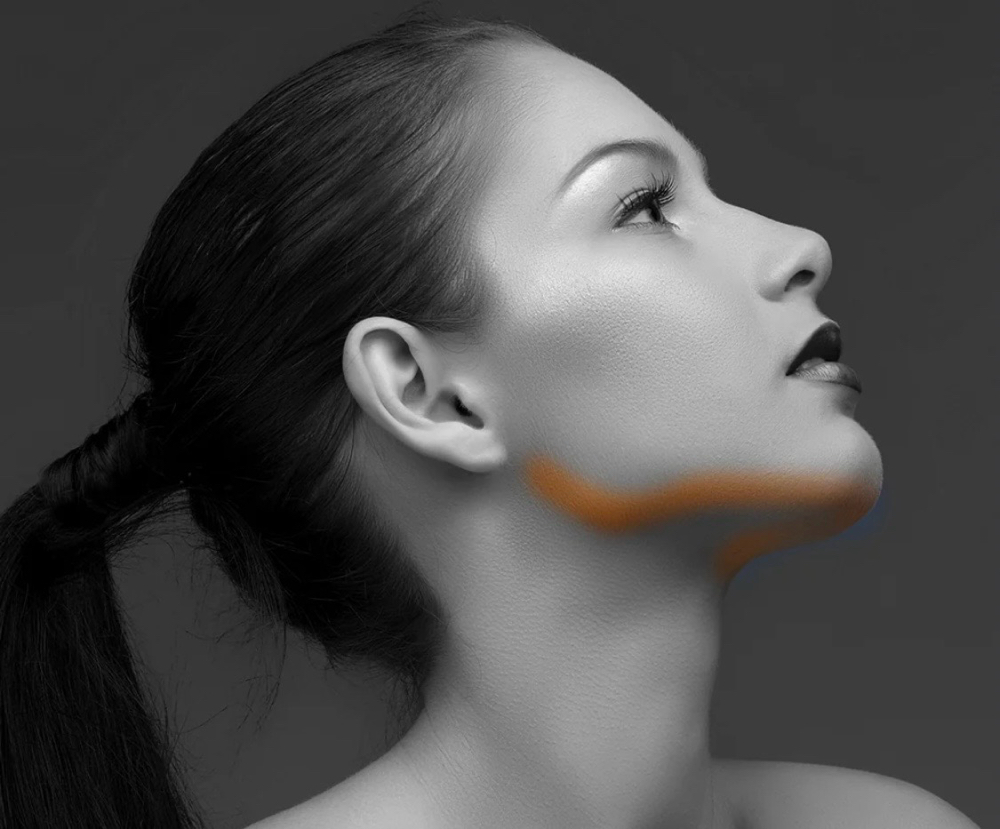 Jawline Laser Hair Removal at M.A.V Aesthetics in Fort Morgan, CO