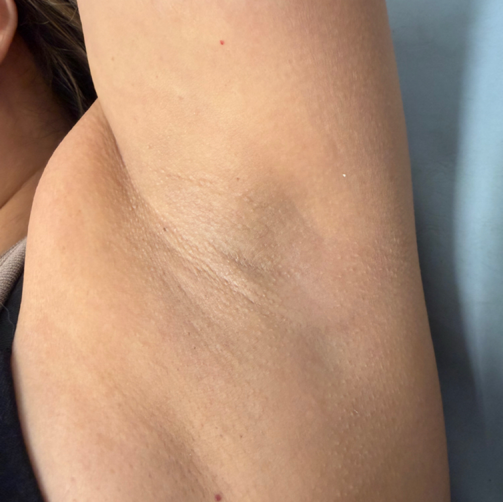 Under Arm Wax at Skinhavenbyjaz in Yakima, WA