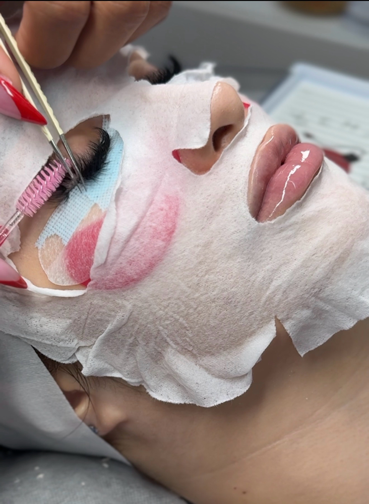 THE ELITE FILLS at Lux Skincare in Phoenix, AZ