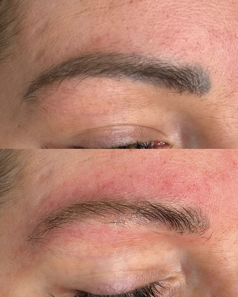 Lightening Pigment Session