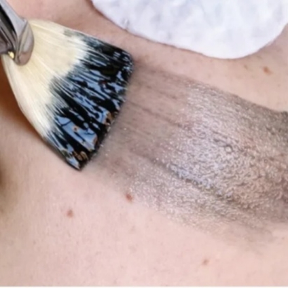 Chemical Peel at Bubalu Skin in Elgin, IL