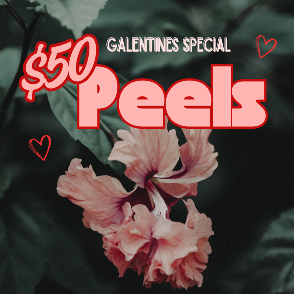Gal-entines Peel Special 💕