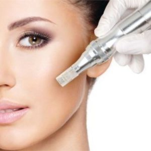 Magazine Microneedling PRP at Empower Aesthetics in Canyon Lake, TX