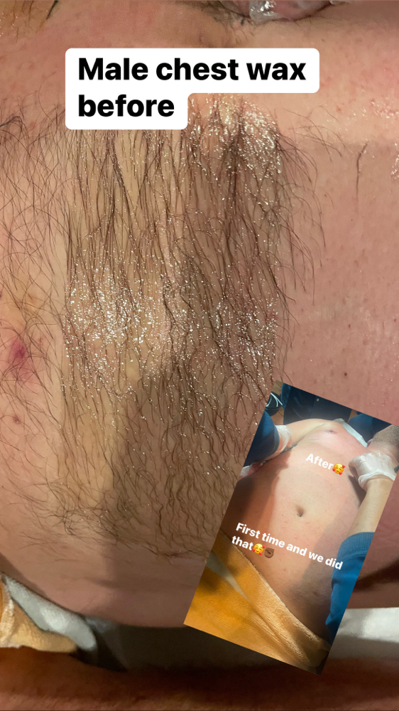 Chest Wax