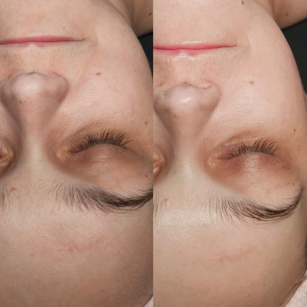 The Oncology Facial at Aligned Beauty & Wellness in Davenport, IA