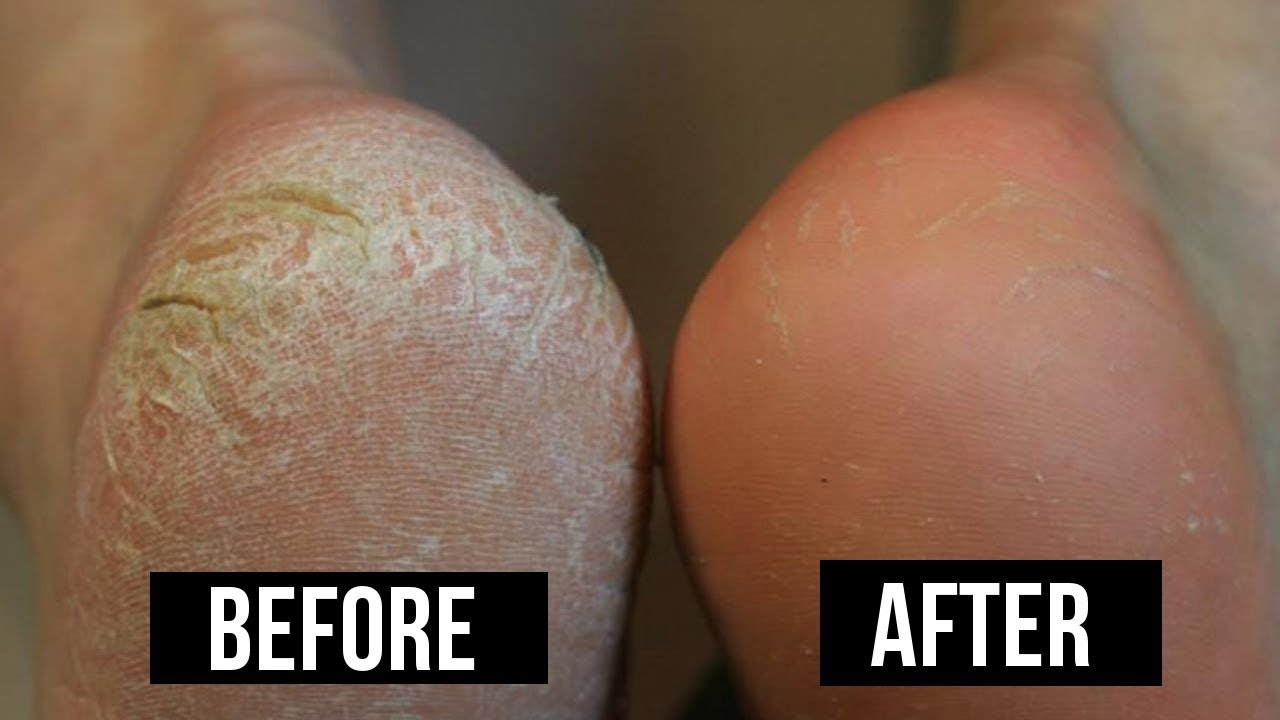 Intense Repair Medi Pedi