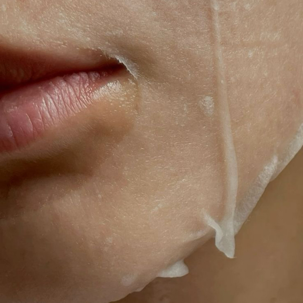 Acne Healing Program at Moonlit Beauty By T in Eagle, ID