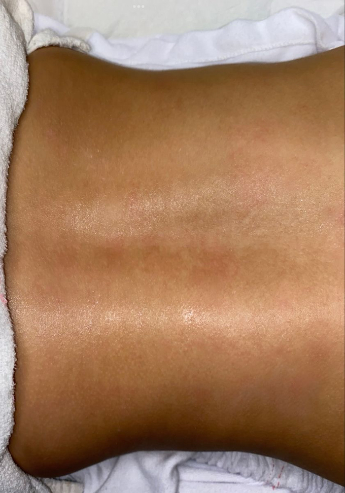 Lower Back Wax